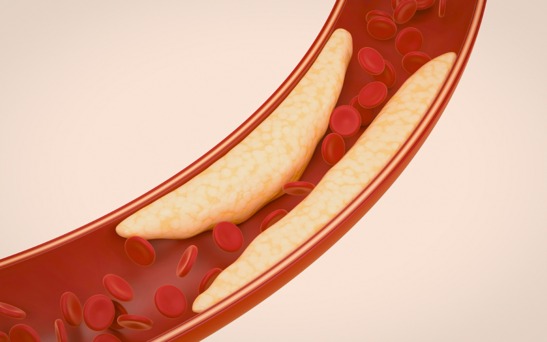 Cholesterol and Cellular Health: What You Need to Know