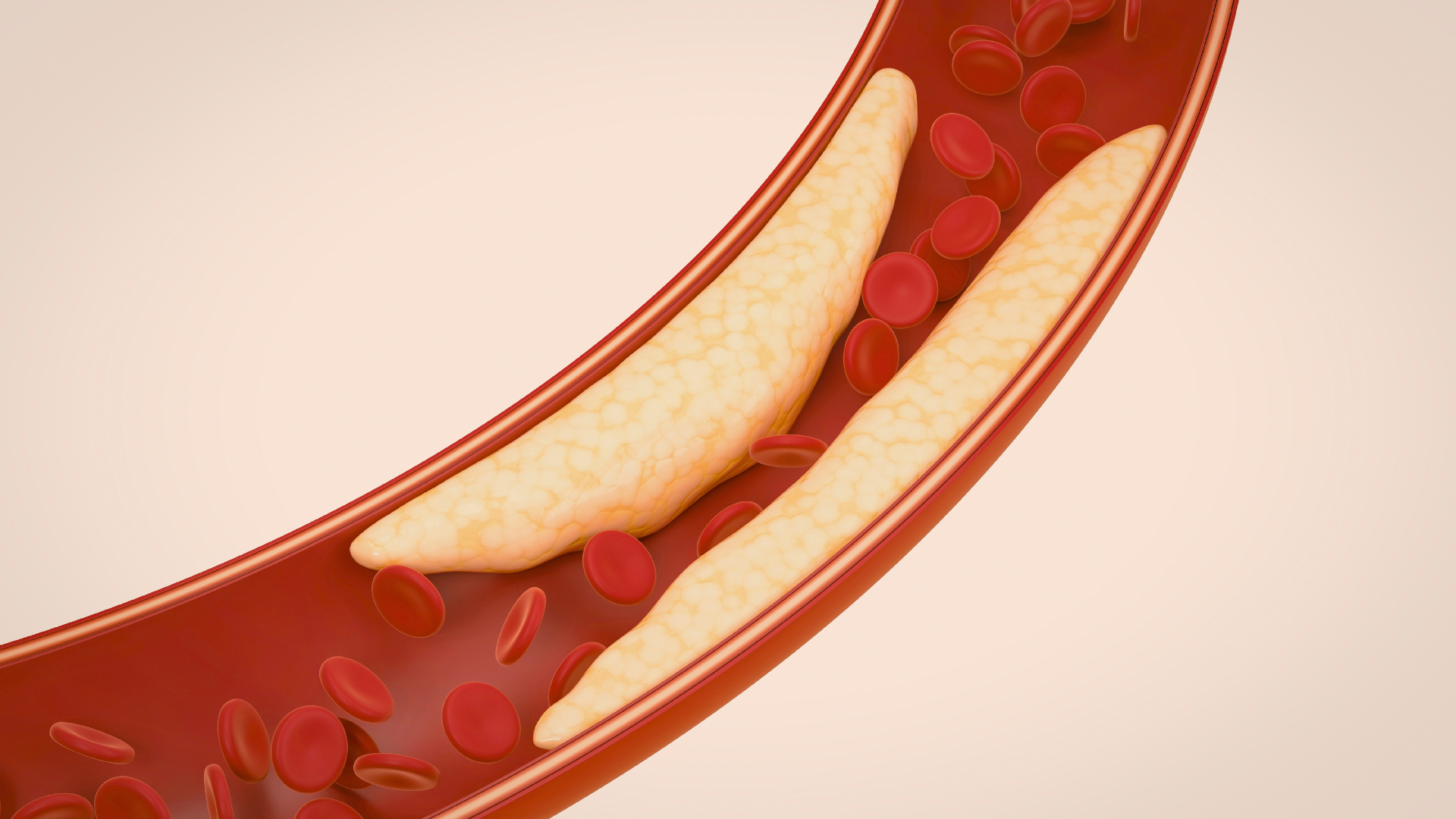 Cholesterol